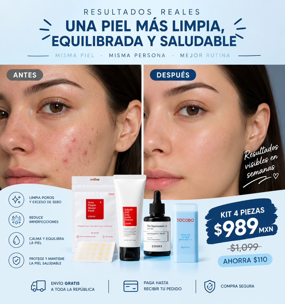 Kit Anti Acné Piel Grasa | Skincare Coreano 4 Piezas | Omere